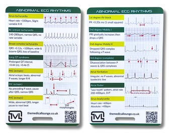 Abnormal Ecg Rhythms – Interpretation Card