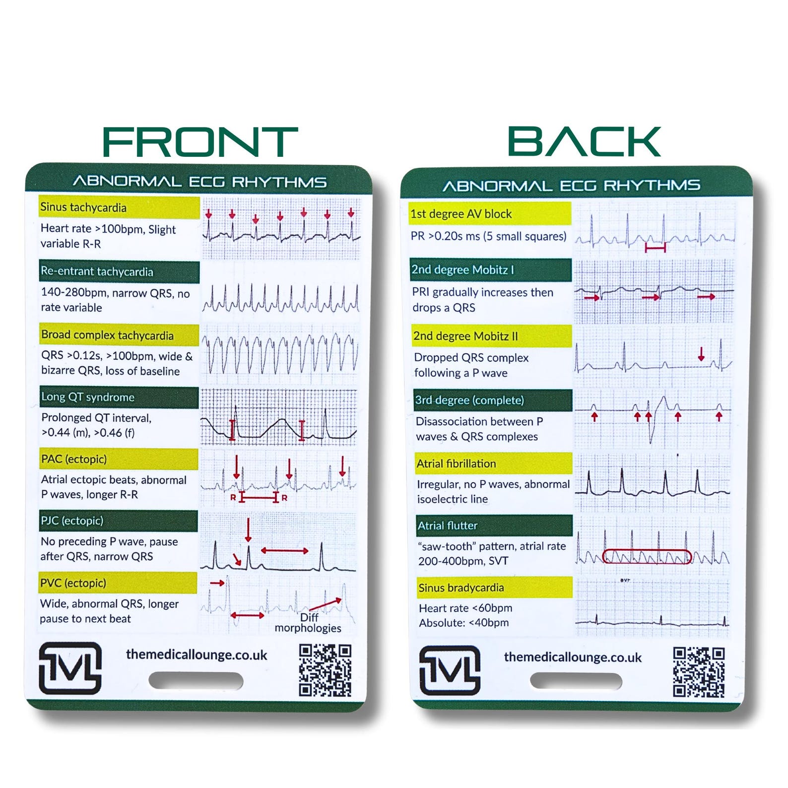 Abnormal Ecg Rhythms – Interpretation Reference Card - Etsy