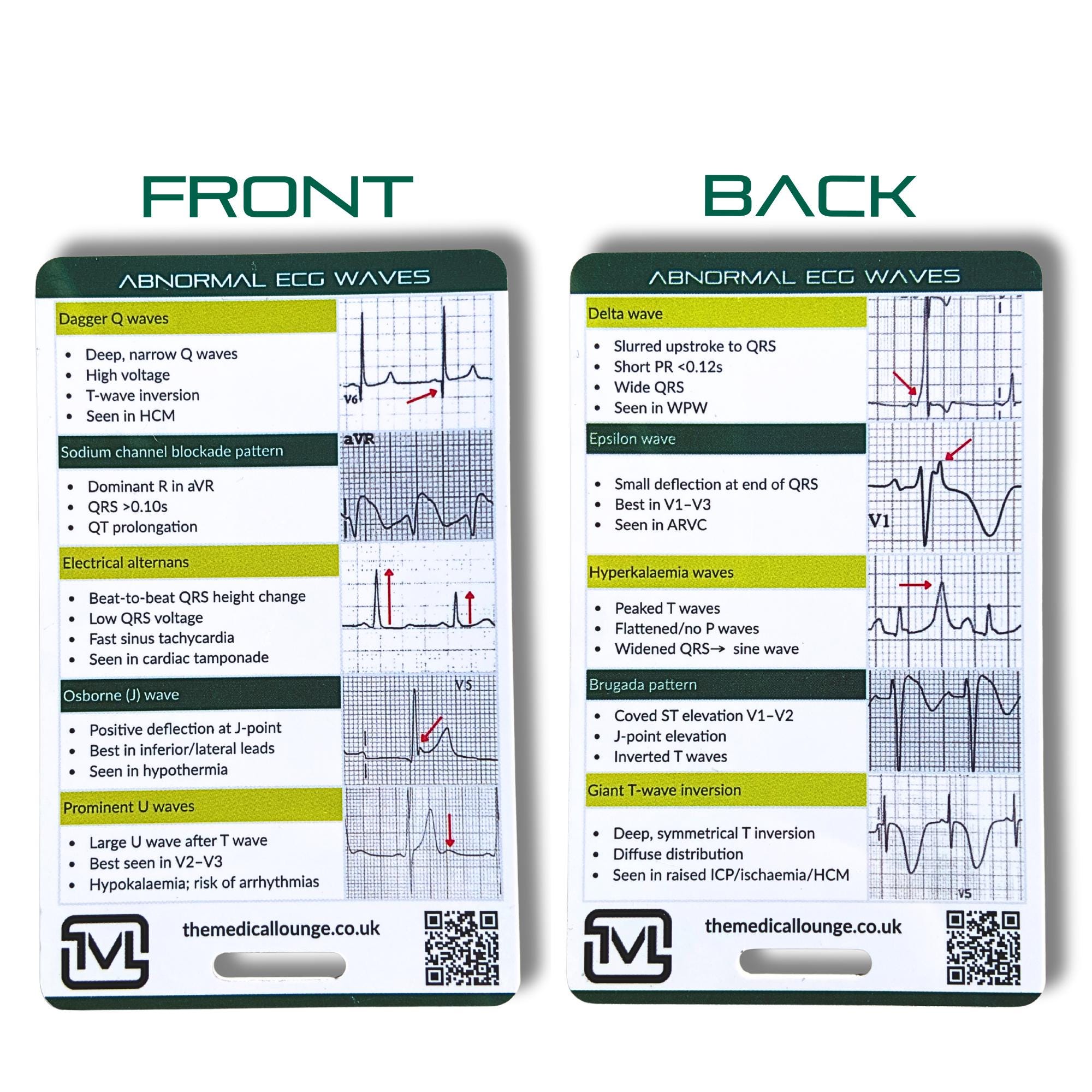 Abnormal Ecg Waves Reference Card | Ecg Study & Revision Aid for ...