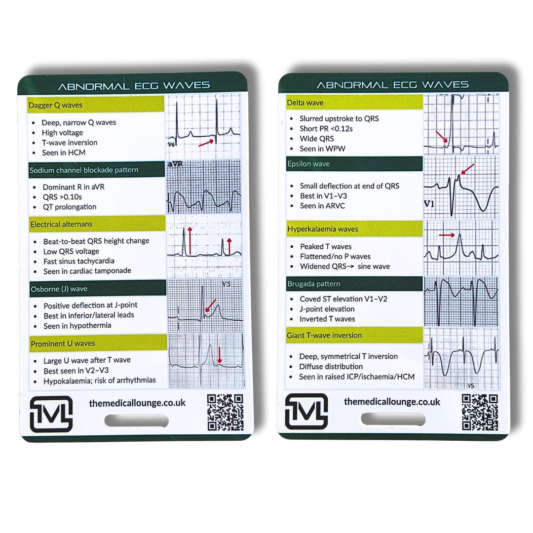 Abnormal Ecg Waves Reference Card - Etsy UK
