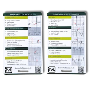 Abnormal Ecg Waves Reference Card | Ecg Study & Revision Aid For Pattern Recognition | Lanyard Reference Card For Paramedics, Nurses  Doctor