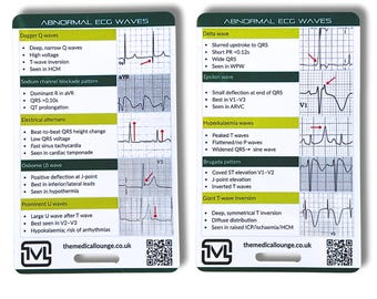 Abnormal Ecg Waves Reference Card