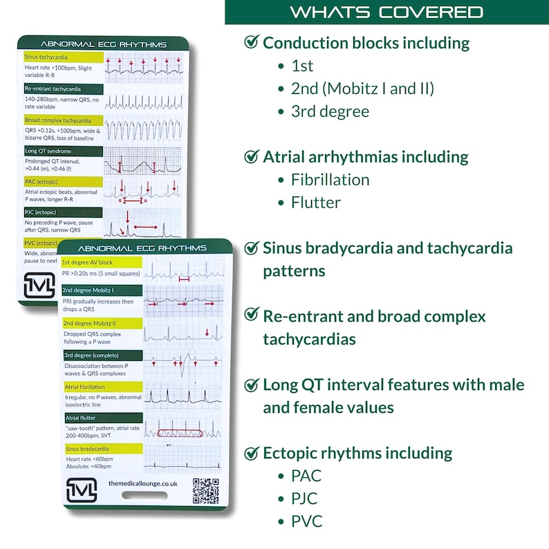 Abnormal Ecg Rhythms – Interpretation Reference Card - Etsy