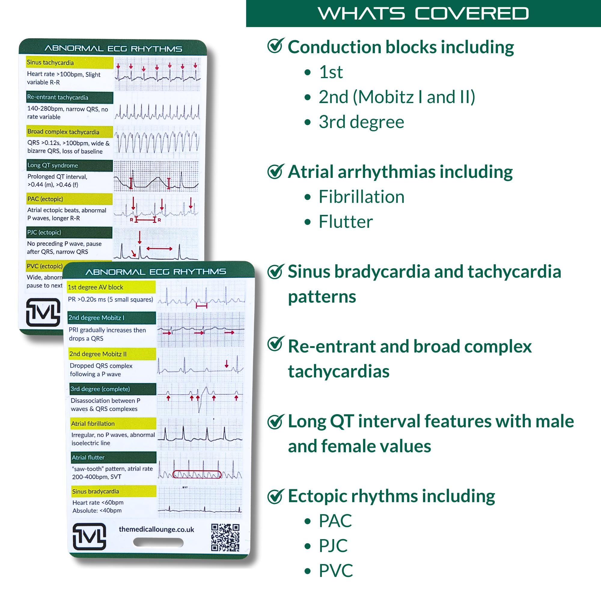 Abnormal Ecg Rhythms – Interpretation Reference Card - Etsy