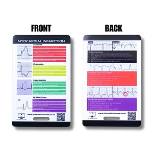 Herzinfarkt EKG-Referenzkarte | 7 Wellenanomalien mit Kriterien und Beschreibungen | Schlüsselkarte für Sanitäter und Krankenschwestern