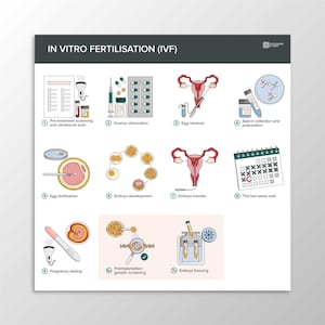 Digital download - IVF Image Bundle - in vitro fertilization, anatomy, educational printable JPEG, clip art, PNG