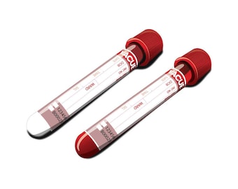 Detailed Vector Blood Test Vials Artwork – Digital Download, Original by Digytl, Includes AI, EPS, JPG (5000px)