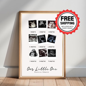 Baby Ultraschall Meilenstein-Druck, personalisierte Schwangerschaft Reise Poster, Benutzerdefinierte Sonogramm Timeline Kinderzimmer Wandkunst