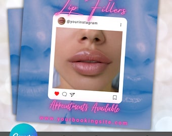 Lip Fillers Flyer Canva Template, Lip Injections Flyer, Russian Lips, Lip Appointments, Aesthetics Flyer, Beauty Business Flyer