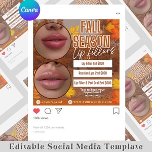 Fall Season Lip Fillers Flyer, Canva Editable Social Media Flyer, Editable Botox Fillers Instagram Post, Digital Lip Injections Template