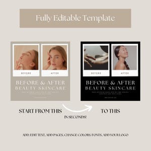 Puede incluir: Im&aacute;genes de antes y despu&eacute;s de un rostro, mostrando los resultados de los cuidados de belleza para la piel. El texto dice "Antes y Despu&eacute;s Cuidado de Belleza para la Piel".