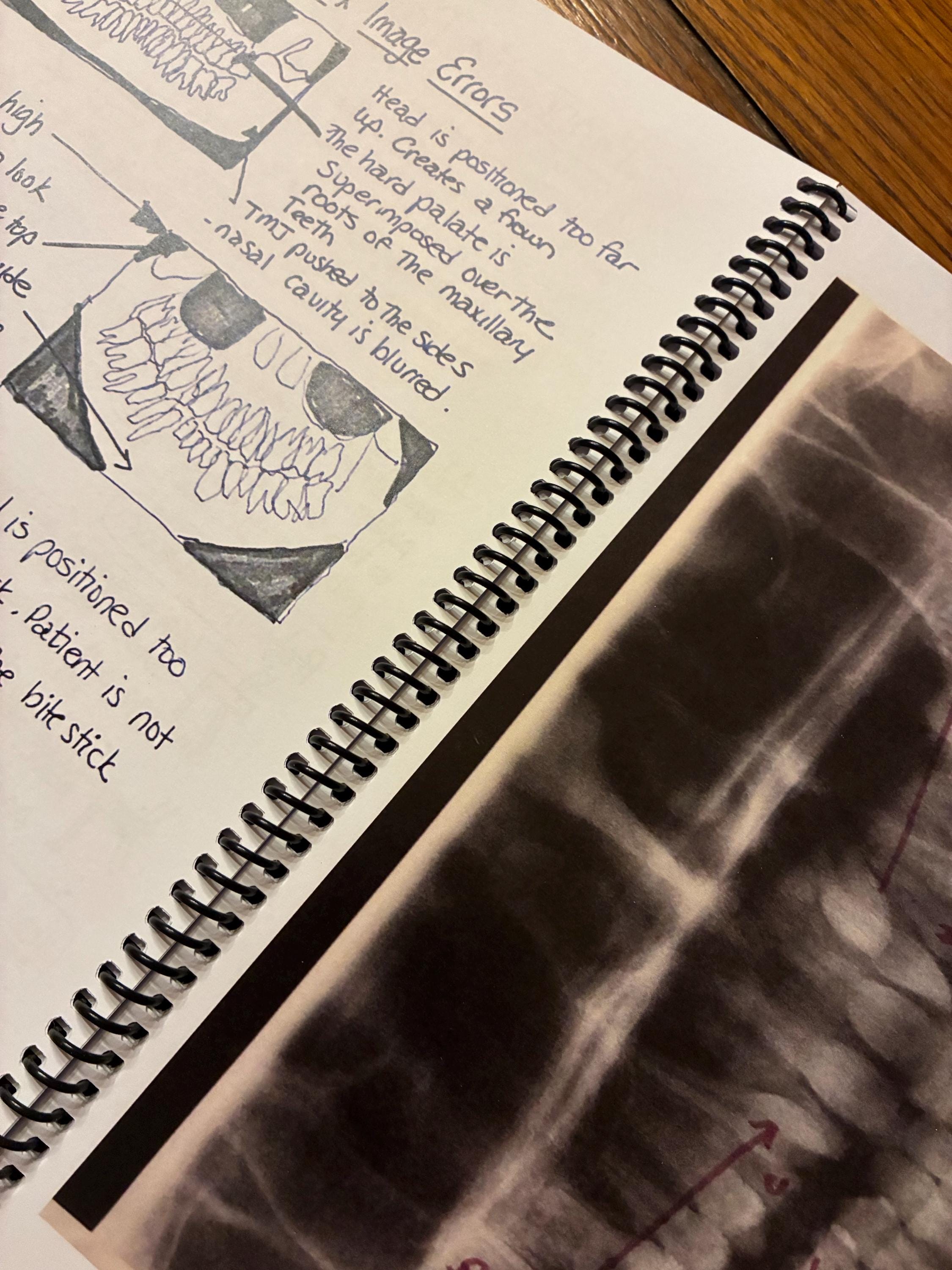 Dental Radiology Study Notes Book: Hygiene & Assisting Students - Etsy