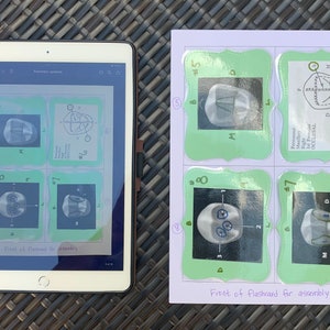 Tooth Flash Card Layout Dental Flashcards Premolar Tooth Morphology for Dental Hygiene Students ...