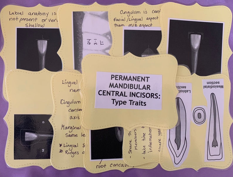 Dental Flashcards Incisor Tooth Morphology for Dental Hygiene Students