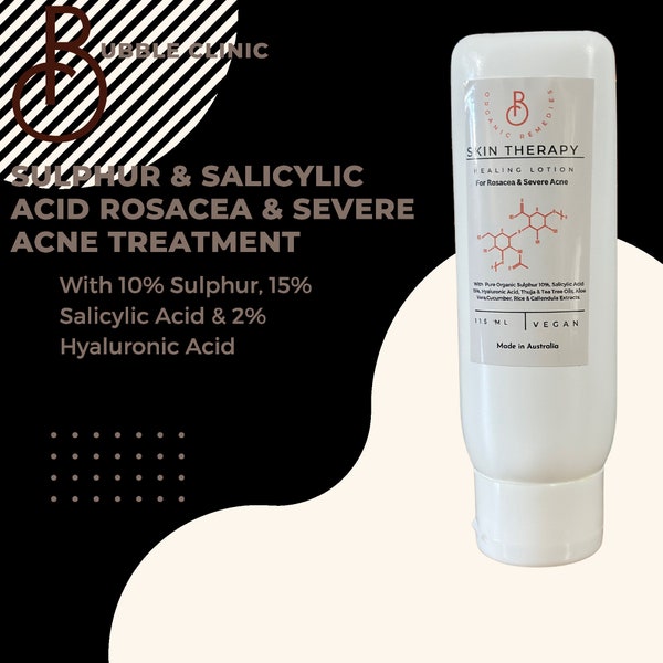 Anti Acne Rosacea Treatment with Salicylic Acid, Sulphur MSM and Hyaluronic Acid, Panthenol, Aloe, Astaxanthin, Moringa Sea Buckthorn oils