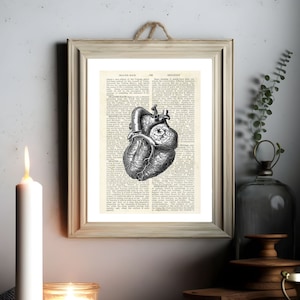 Art de page de livre ancien d'anatomie coronarienne, impression anatomique de coeur, affiche d'anatomie du coeur, anatomie humaine imprimable, art sombre coeur vintage