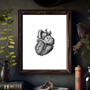 Vintage Heart Anatomy Print: Coronary Diagram Poster (Digital Download)