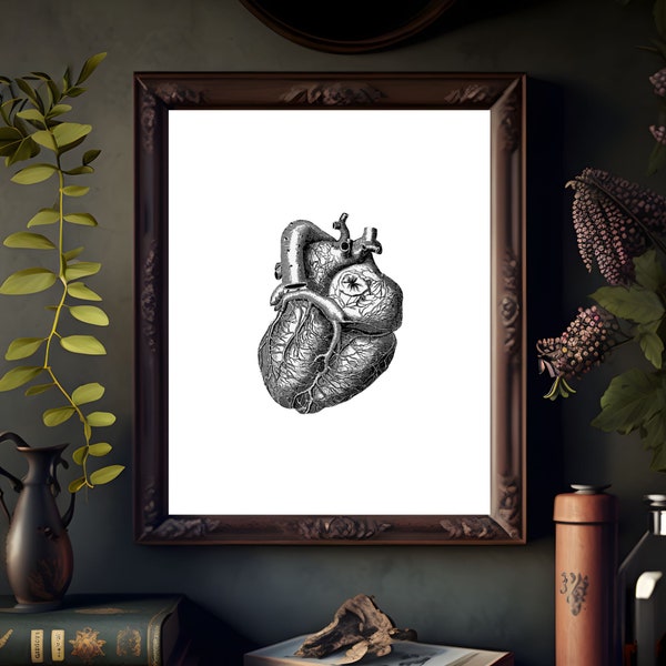 Coronary Anatomy Poster of the Heart, Vintage Anatomical Heart Print, Anatomy Reference Diagram, Anatomy and Physiology Poster, Dark Art