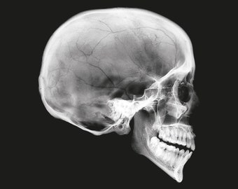 X-RAY human SKULL imaged on photographic film light box 227x160mm HALLOWEEN