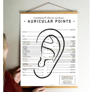 May include: A black and white illustration of an ear with labeled points representing different parts of the body. The illustration is titled "Traditional Chinese Medicine - Auricular Points".