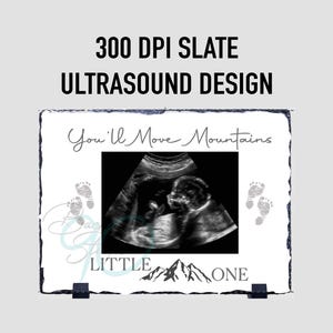 May include: A rectangular slate ultrasound design with the text "300 DPI SLATE ULTRASOUND DESIGN". The design includes an ultrasound image, baby footprints, and the words "You'll Move Mountains" and "Little One".