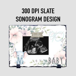 May include: A slate sonogram design with the text "300 DPI SLATE SONOGRAM DESIGN". The design features a baby ultrasound image, a baby elephant illustration, and the word "BABY". The design is decorated with pink flowers and green leaves.