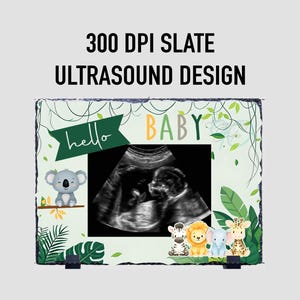 Peut inclure: Une conception d'échographie sur ardoise avec une image de sonogramme de bébé. Le design comprend le texte "hello BABY" et des animaux de dessins animés comme un koala, un zèbre, un lion, un éléphant et une girafe. Le design est entouré de feuilles et de vignes vertes.
