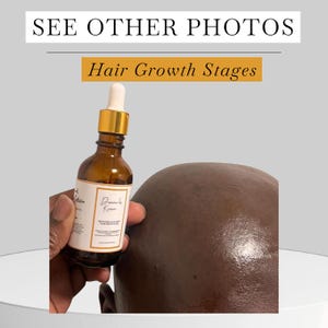 May include: A brown glass bottle with a gold cap and white label is held near a person's head. The label reads "Dannale Krown" and "Hair Growth Stages". The text "SEE OTHER PHOTOS" and "Hair Growth Stages" are also visible.