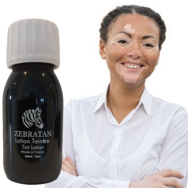 Make-up, Vitiligo abdecken Zebratan Lotion Mittelbraun.