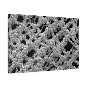 May include: A grayscale image of a microscopic structure, possibly biological. The image shows a complex network of interconnected strands and clusters of small, spherical shapes, creating a textured, porous appearance. The background is dark, enhancing the contrast of the detailed structure.