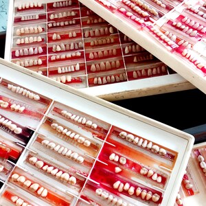 Puede incluir: Varias bandejas blancas llenas de moldes dentales, cada una con filas de dientes. Los dientes están dispuestos en compartimentos transparentes y teñidos de rojo. Los dientes varían en tamaño y forma, ofreciendo una exhibición detallada de especímenes dentales.