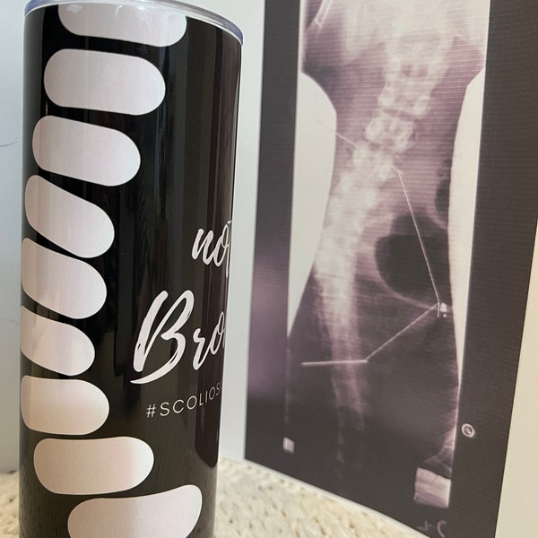 Bent not Broken Scoliosis Tumbler