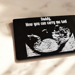 Cartão de carteira de ultrassonografia de bebê personalizado, leve, alumínio, marido, esposa, presente, gravidez, maternidade, papai, mamãe, ultrassom, chá de bebê