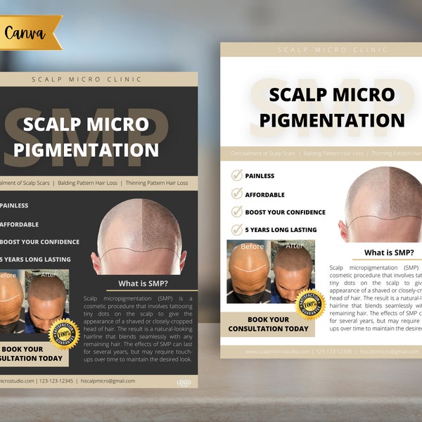 Scalp Micro pigmentation flyer | editable smp flyer | Customizable SMP Flyer | CANVA SMP Flyer