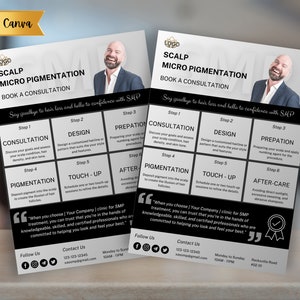 DIY Scalp Micro pigmentation flyer | editable smp flyer | beauty and wellness | smp marketing and branding | smp information sheet