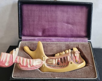 Diente, nervio mandibular, caries: original de época de los años 40 y 50 en un estuche a juego forrado de terciopelo.