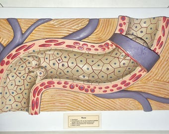 Rare find: XXL Somso plaster model of a vein, over 60 cm long, vintage (1950s), mounted on a wooden base, approx. 6 kg