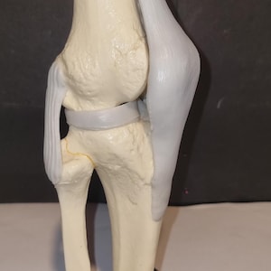 May include: A detailed anatomical model of a human knee joint, showcasing the femur, tibia, patella, and ligaments. The model is in a neutral color palette, mounted on a black base, and provides a clear view of the skeletal structure.