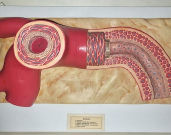 Rare find: XXL Somso plaster teaching model of an artery, over 60 cm long, vintage (1950s), mounted on a wooden base, approx. 6 kg
