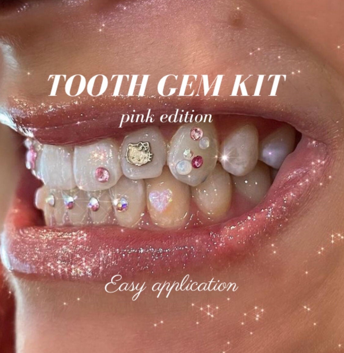 So Icy DIY Tooth Gem Kit heart Edition 