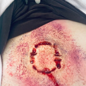 May include: A close-up of a fake bloody wound on a person's skin. The wound is shaped like a circle with teeth marks around the edge. There is a trail of blood running down from the wound.