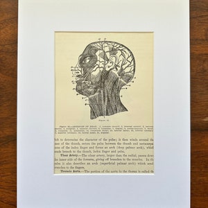 Arteries of Head, Cut from &quot;Library of Health&quot;
