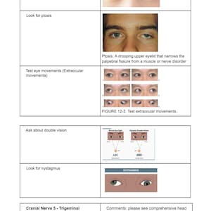 Könnte beinhalten: Lehrdiagramm zur Veranschaulichung von Hirnnerventests. Enthält Bilder von Augenbewegungen, Ptosis und Nystagmus. Text beinhaltet "Ruheblick untersuchen", "Ptosis suchen" und "Augenbewegungen testen".