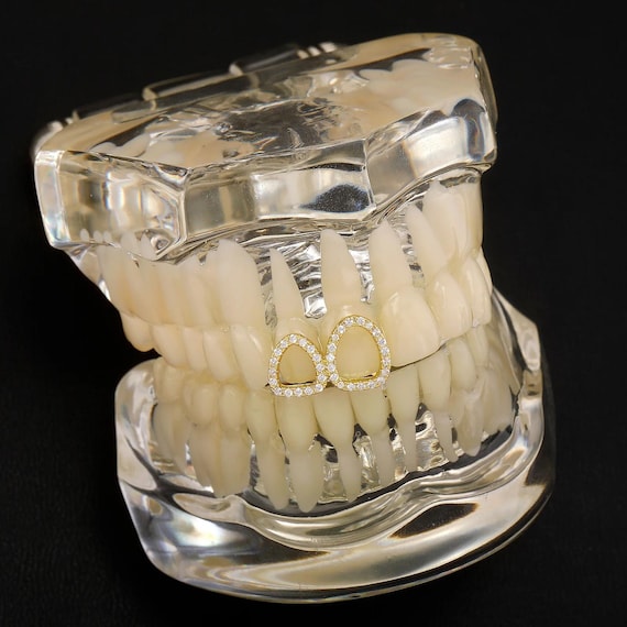 18k Gold Diamond 2 Tooth Window Grillz, Double window grillz, tooth cap, open face grillz, fang grillz, custom grillz, gold grillz,