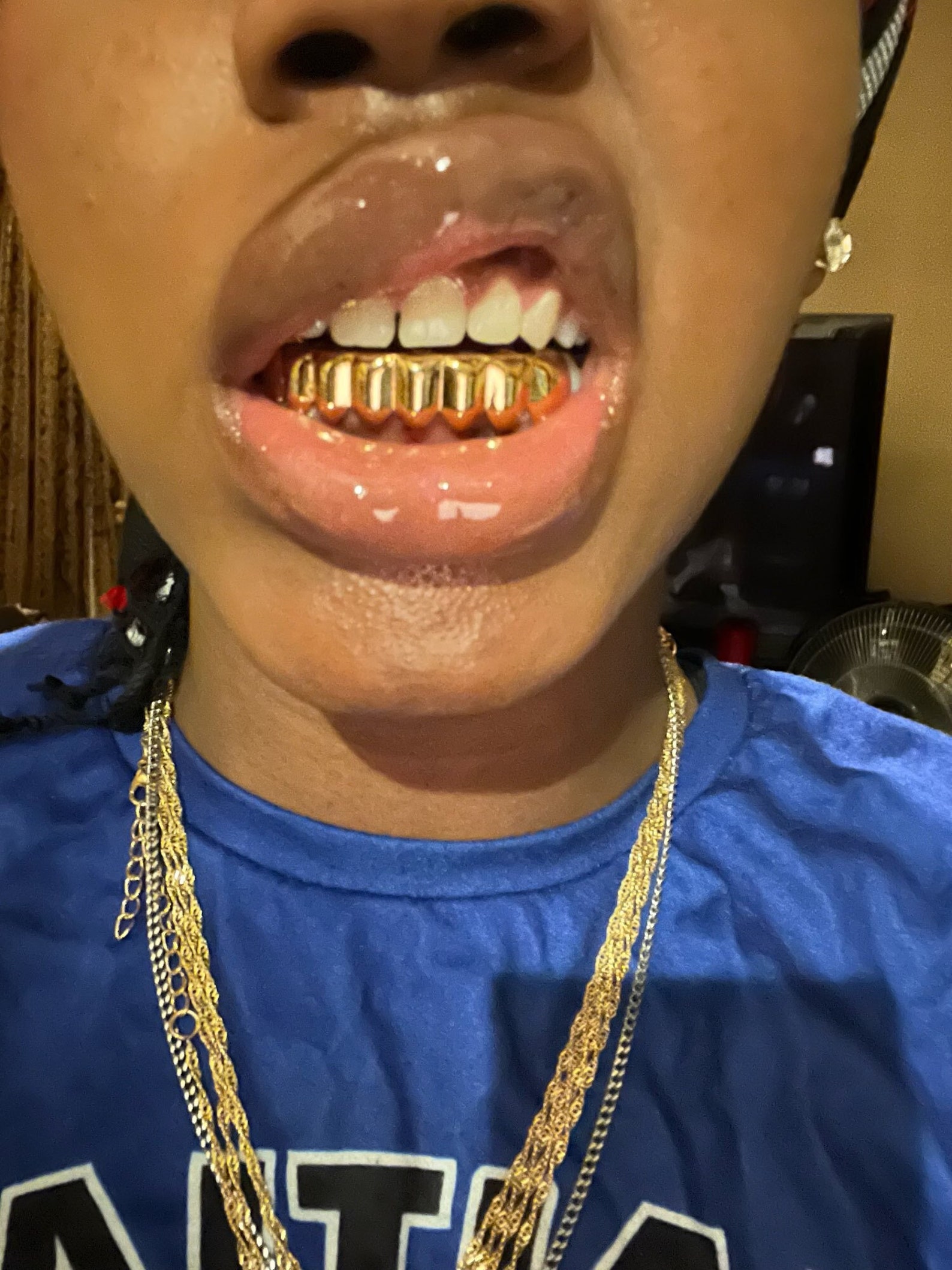 Gold Grillz, Silver Grillz, Rose Gold Grillz, Grillz Teeth, Top Grill