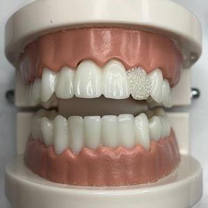 May include: A dental model displaying a set of teeth with a sparkling, crystal-like embellishment on one tooth. The model features white teeth set in pink gums, mounted on a white base.