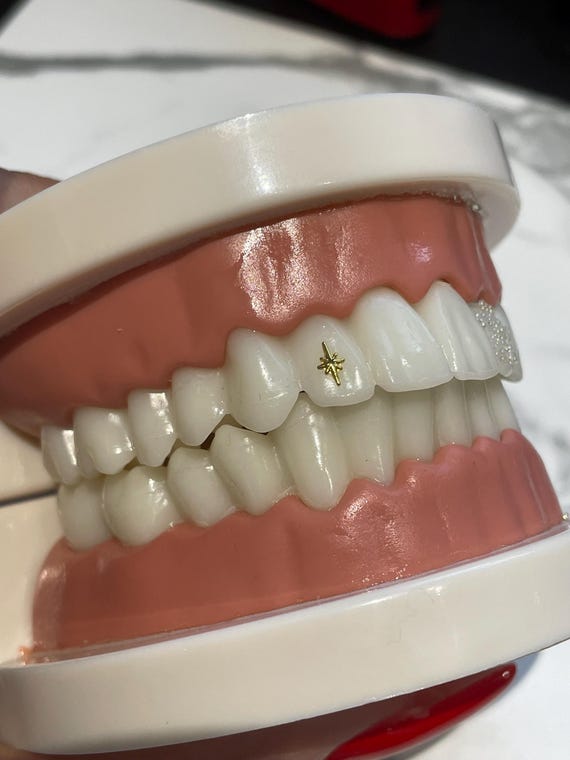 Gold Sparkle Tooth Gem