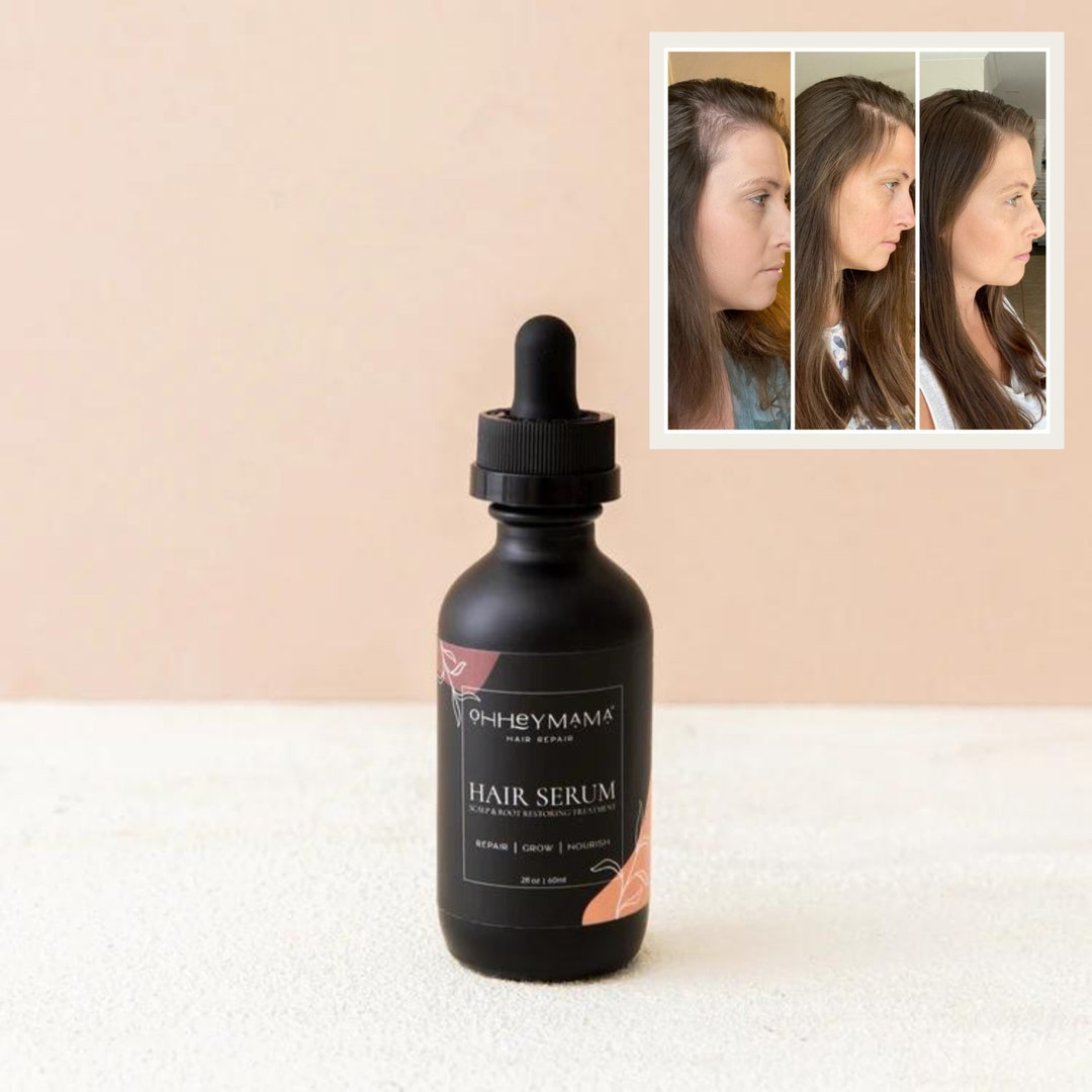 Oil Serum for Hormonal Hair Loss Natural Hair Growth Oils for Thinning