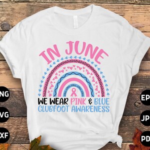 Klumpfuß-Bewusstseins-Svg-Png, im Juni tragen wir rosa & blau Klumpfuß-Regenbogen-Svg, rosa und blaues Band-Svg Cricut Sublimationsdesigns