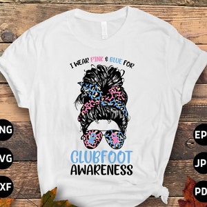 Klumpfuß-Bewusstseins-Svg-Png, ich trage rosa & blau für Klumpfuß-Messy Bun-Svg, rosa und blaues Band-Svg-Cricut-Sublimations-Designs